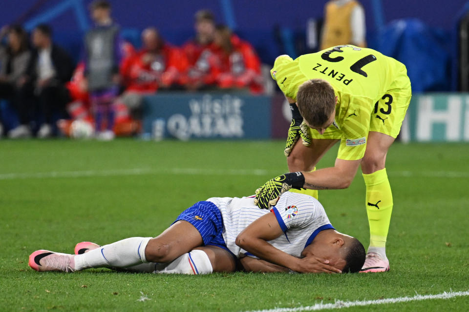 Kylian Mbappé's nose was left bloodied and feared broken on Monday. (Photo by Ozan Kose/AFP via Getty Images)