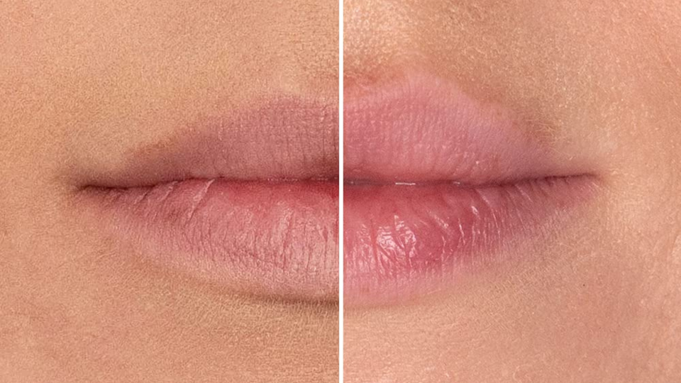 The gloss can provide substantial plumping while keeping your lips looking natural. (Amazon)