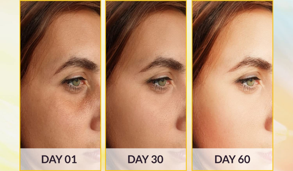 3 images of the same woman's face taken at Day 1, Day 30 and Day 60, with more even texture and brighter skin each time