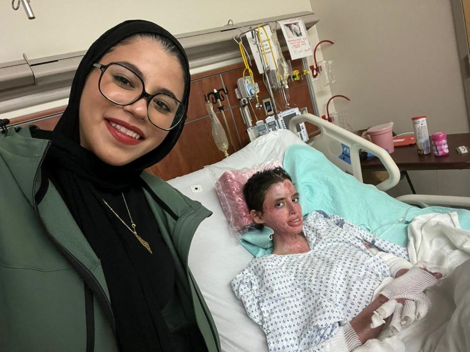 PHOTO: Sara (right), with her sister Seham, being treated at Staten Island University Hospital Burn Center after being medically evacuated to the U.S. (Courtesy of Seham Besaiso)