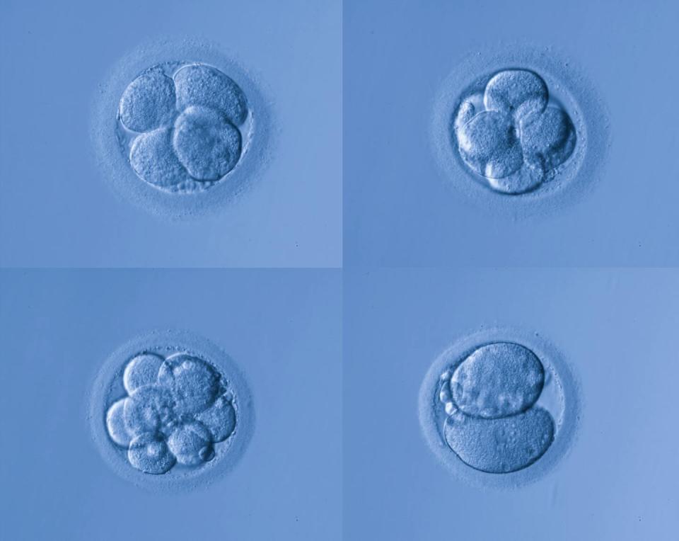 Microscopy image of four early human embryos