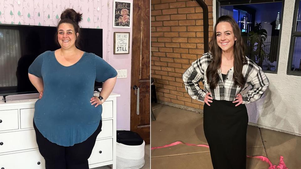 PHOTO: Leah Hope says she lost over 200 pounds over the course of two years. (Leah Hope)