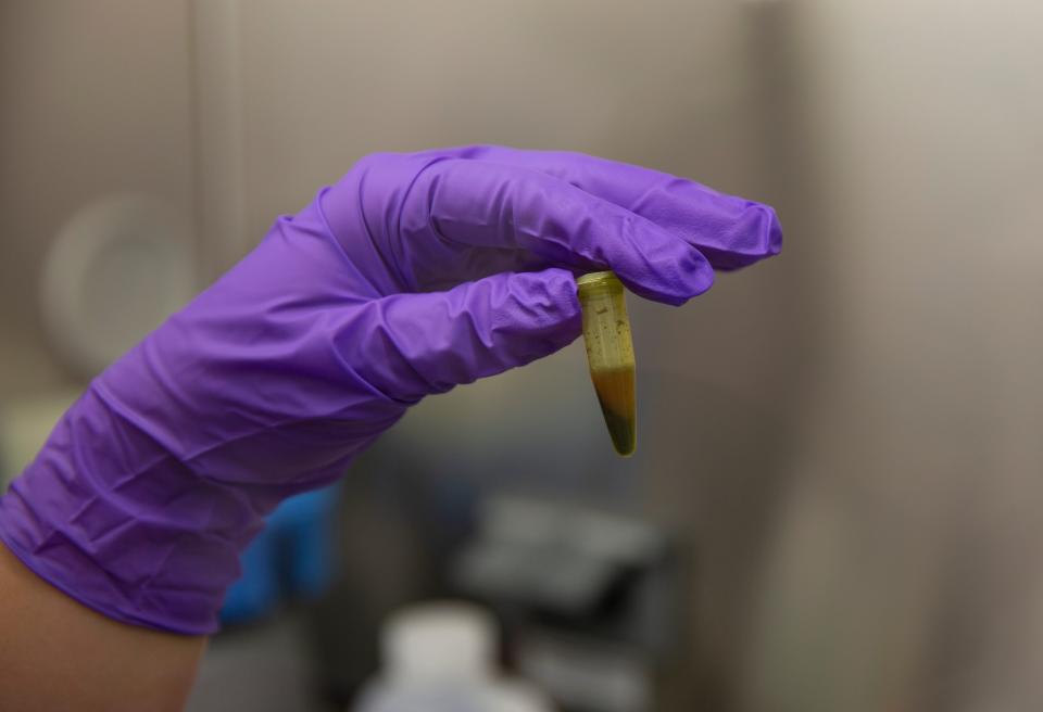 Lab technician Alexandria Watkins processes a sample of Aedes Aegypti mosquitos to see if they carry the dengue virus, Monday, July 20, 2020, at Collier Mosquito Control District offices in Naples. This is not the city referenced in this story.