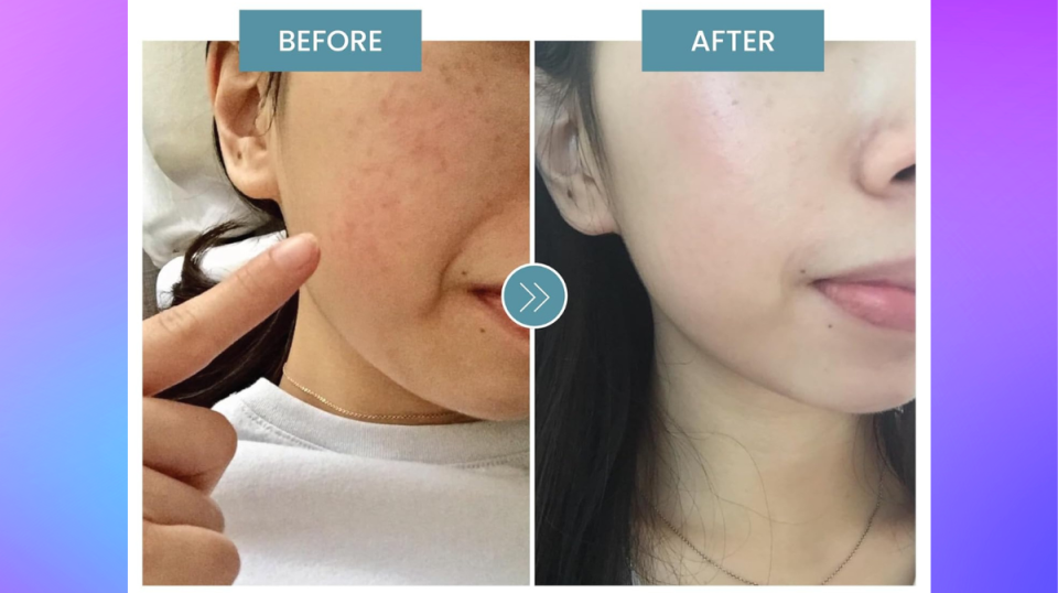 See the difference with Eva Naturals — and an infusion of collagen-boosting peptides! (Amazon)