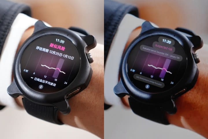 Oppo watch x2 oneplus watch 3 blood pressure monitor.